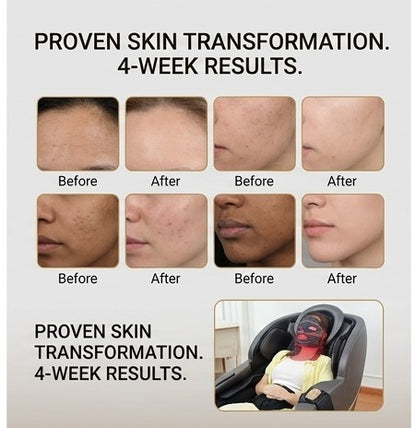 ChromaGlow LED — Facial Phototherapy Mask